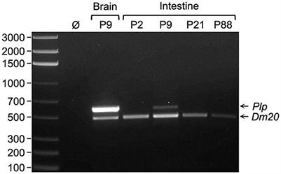 Plp1 in the enteric nervous system is preferentially expressed during early postnatal development in mouse as DM20, whose expression appears reliant on an intronic enhancer